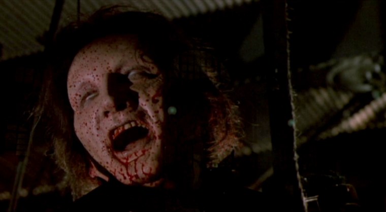 That's one of the early signs of gum disease, that